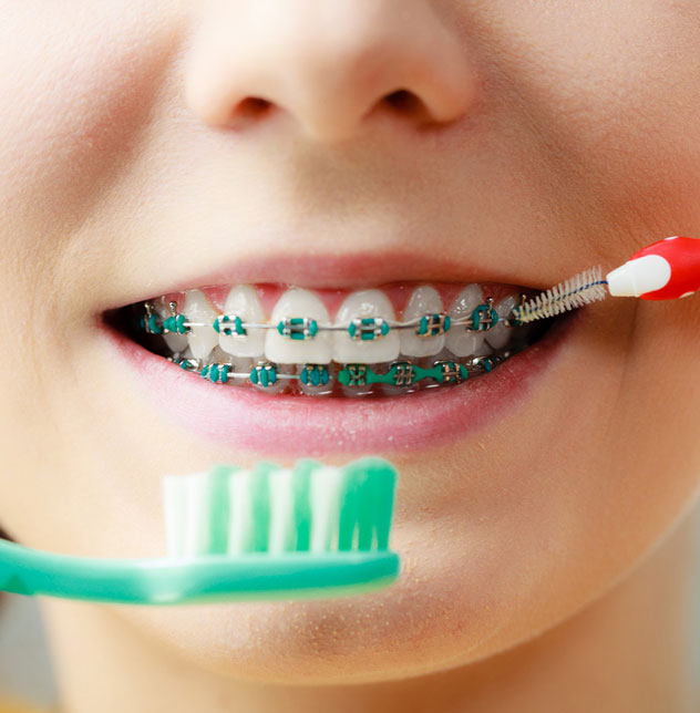 Braces treatment with your comfort in mind Braces treatment with your comfort in mind