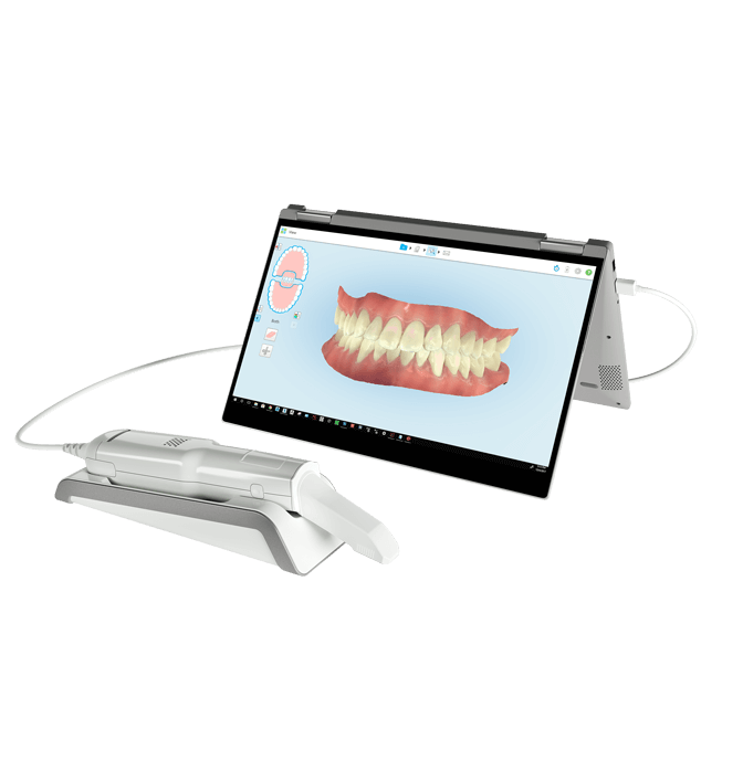 iTero intraoral scanner